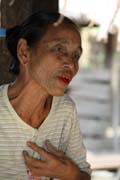 Woman from Chin tribe, Mrauk U area. Women have tradtionaly tattooed their faces. Myanmar (Burma).
